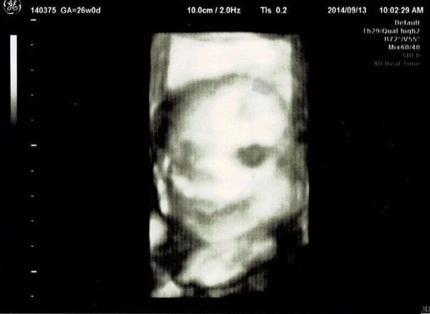 妊娠26週 赤ちゃんのエコー写真 超音波写真まとめ たまひよ 妊娠26週 赤ちゃんのエコー写真 超音波写真まとめ たまひよ