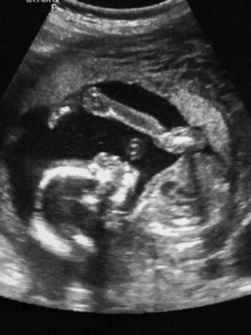 推定体重 胎児発育曲線etc おなかの赤ちゃんの大きい 小さいって 産婦人科医にきくq a たまひよ