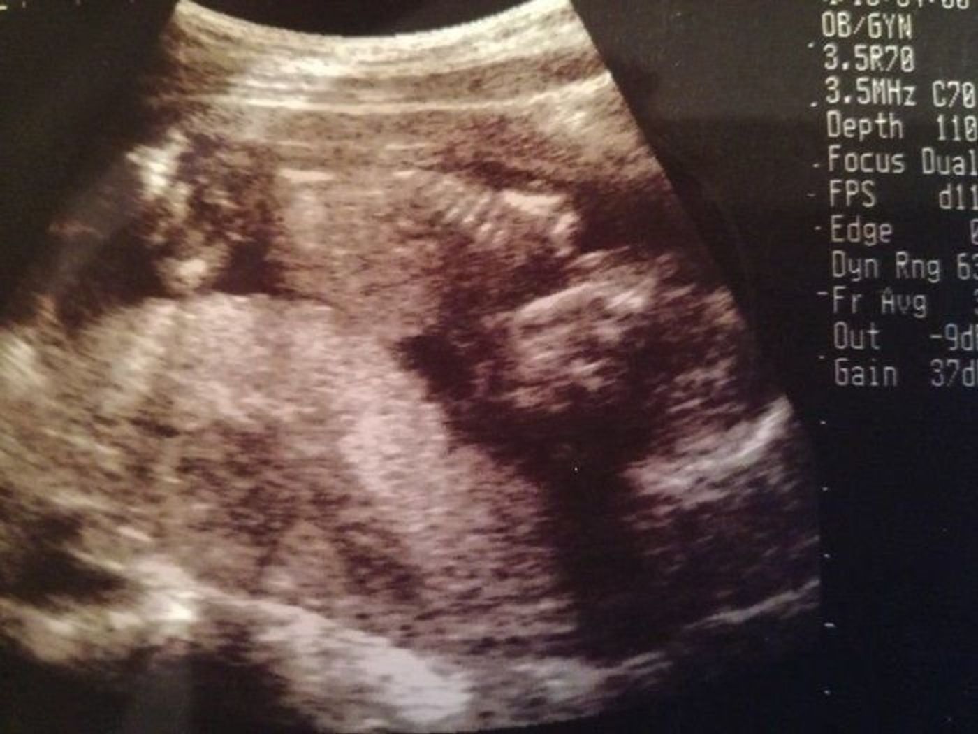 妊娠16週 赤ちゃんのエコー写真 超音波写真まとめ たまひよ 妊娠16週 赤ちゃんのエコー写真 超音波写真まとめ たまひよ