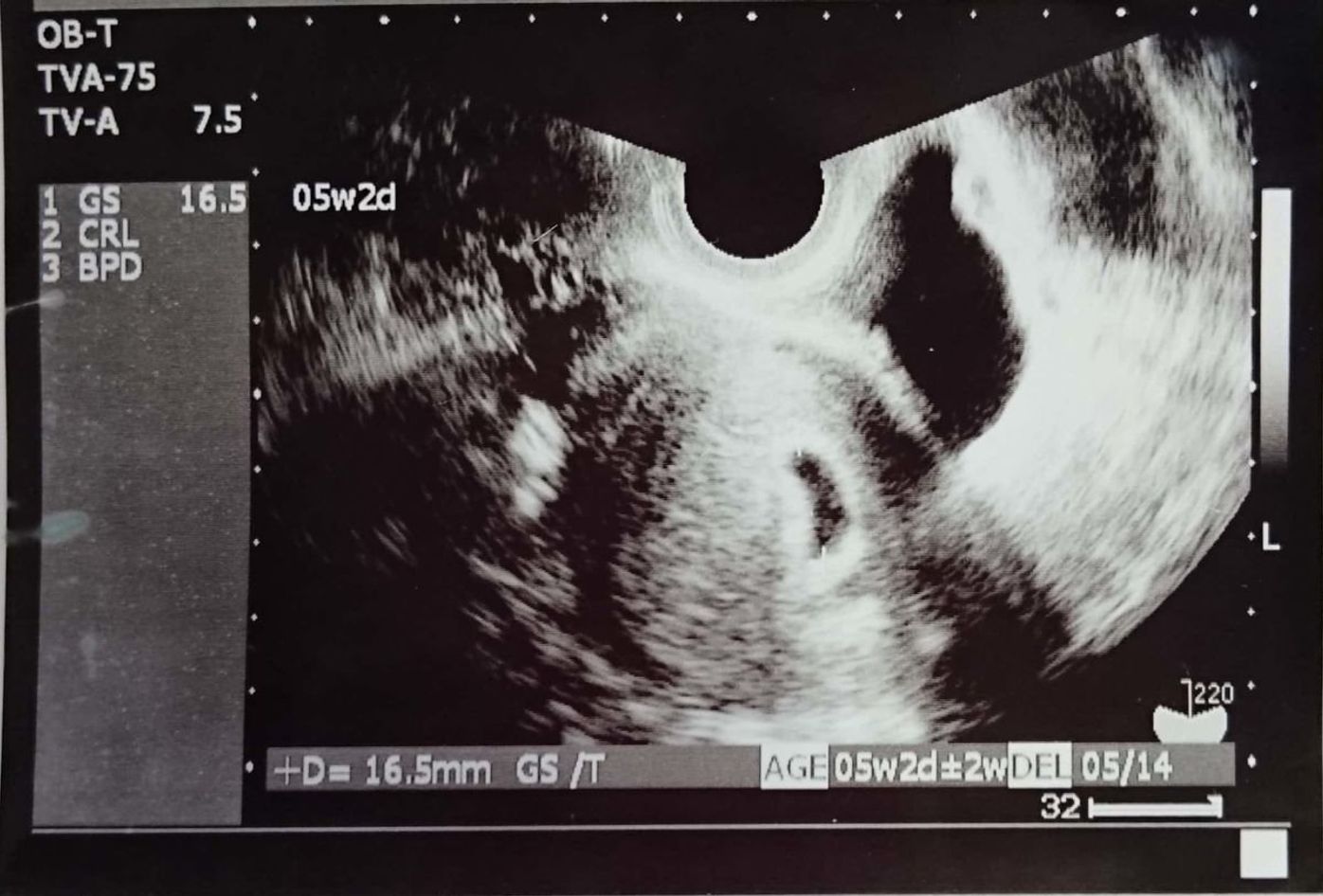 おなかの中にいる時からそっくり 今見ても笑っちゃう 第1子エコー写真 たまひよ