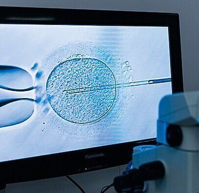 形態がよく、運動性の高い精子をセレクトし、受精操作を行う顕微授精の様子。