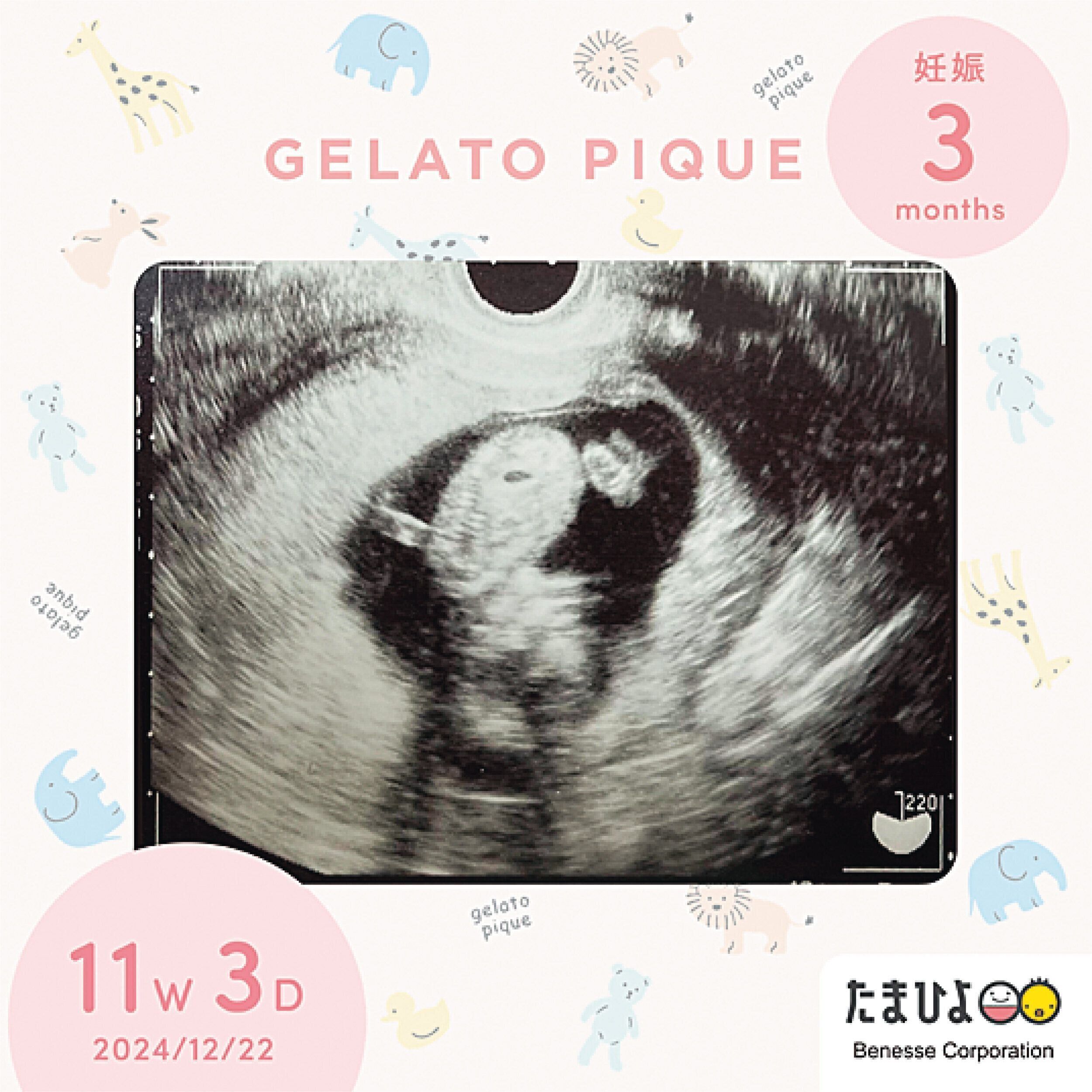 エコー写真デジタルフレーム