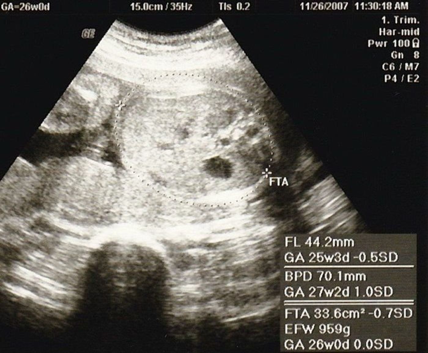 妊娠26週 赤ちゃんのエコー写真 超音波写真まとめ たまひよ 妊娠26週 赤ちゃんのエコー写真 超音波写真まとめ たまひよ