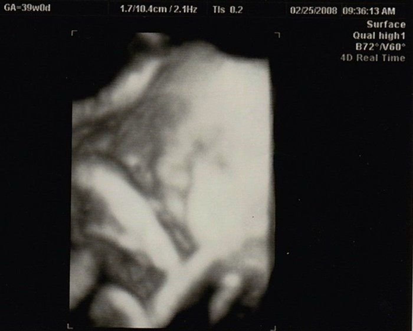 妊娠39週 赤ちゃんのエコー写真 超音波写真まとめ たまひよ 妊娠39週 赤ちゃんのエコー写真 超音波写真まとめ たまひよ