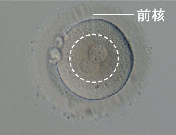 正常な受精卵(胚といいます)は、卵子と精子由来の前核と呼ばれる遺伝子情報を持つ部分が2つ確認できます。採卵の翌日に確認でき、この胚は2PN胚と呼ばれます。