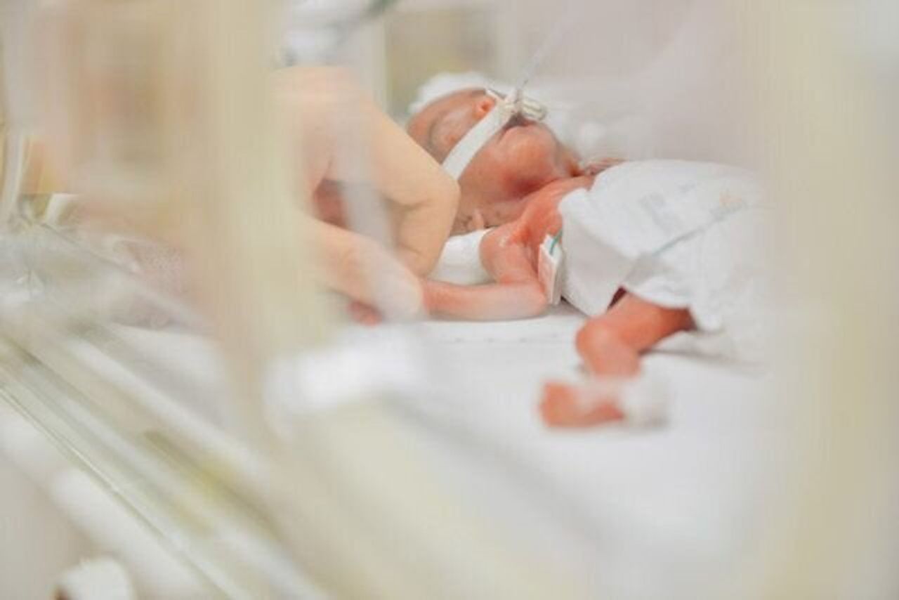 生存率50 と言われ中絶も考えた 431gで生まれた超低出生体重児 祷結ちゃんの成長の奇跡 たまひよ 生存率50 と言われ中絶も考えた 431gで生まれた超低出生体重児 祷結ちゃんの成長の奇跡 たまひよ