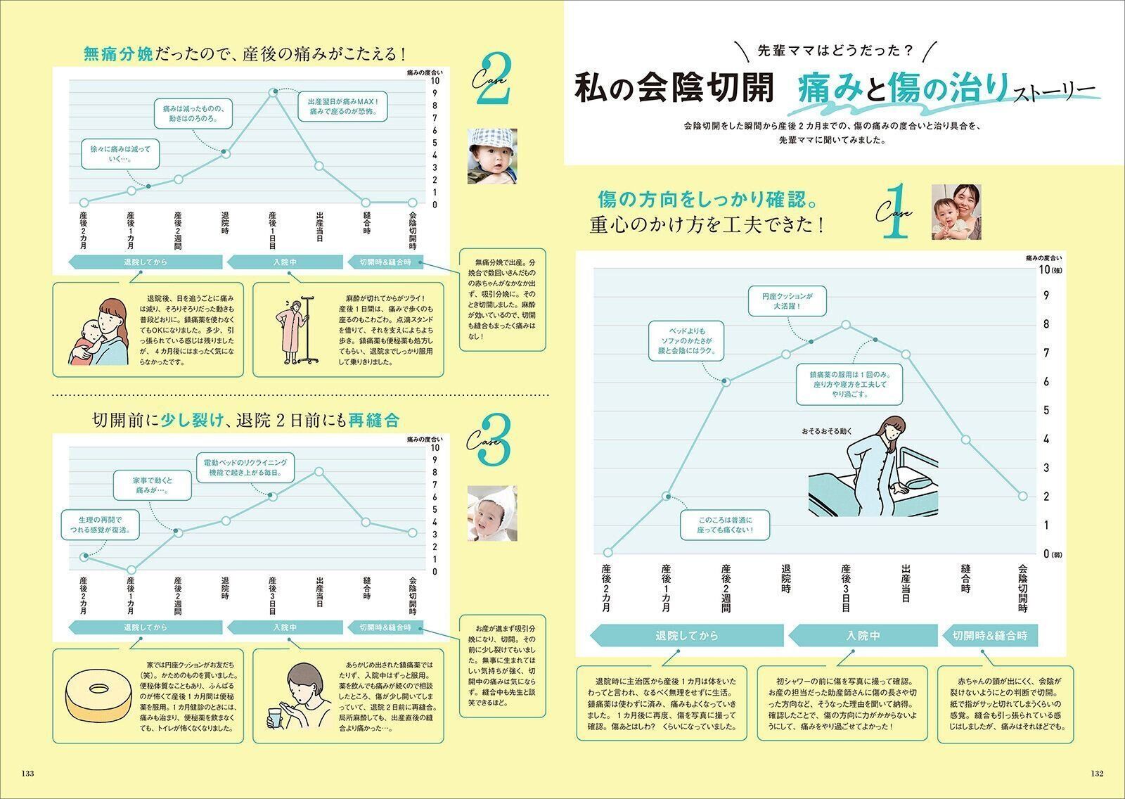 【特集】会陰切開(えいんせっかい)の不安と痛みを和らげるコツ教えます！