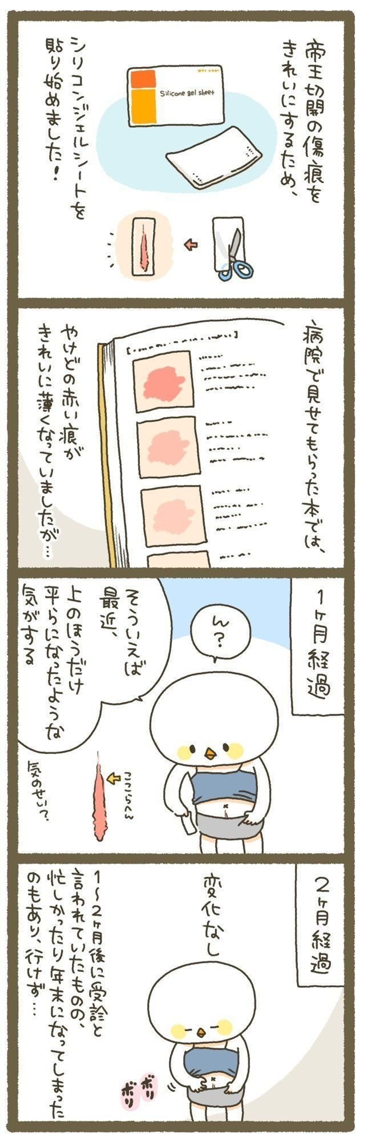 シリコンジェルシートの効果やいかに 10年ぶりに出産しました 140 たまひよ シリコンジェルシートの効果やいかに 10年ぶりに出産しました 140 たまひよ