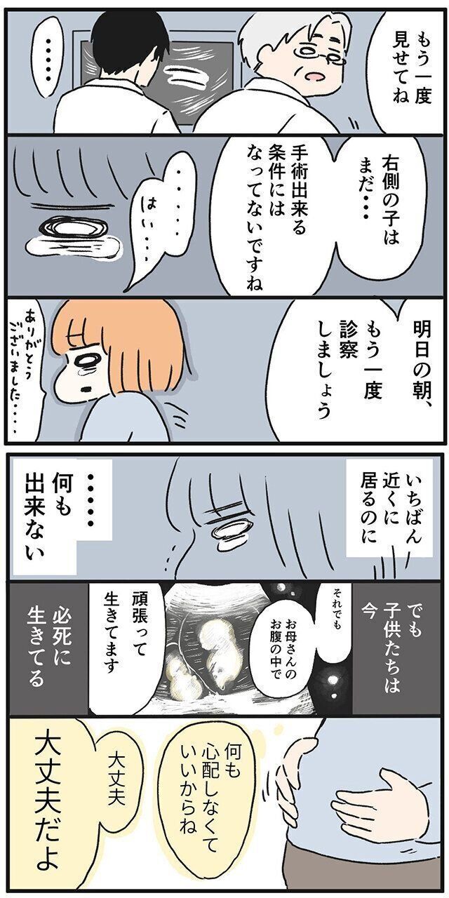 双子妊娠・出産体験談　さゆりさん“双胎間輸血症候群”になった話