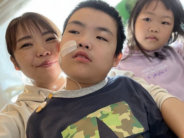 庄司さん,結節性硬化症