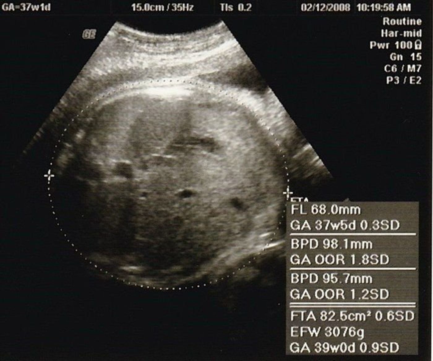 妊娠37週 赤ちゃんのエコー写真 超音波写真まとめ たまひよ 妊娠37週 赤ちゃんのエコー写真 超音波写真まとめ たまひよ