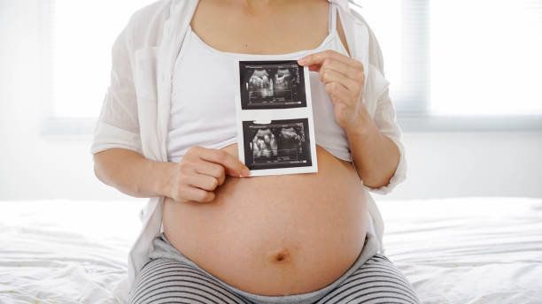 彼女が彼女の手、高いキーに超音波スキャンを保持する間、妊婦の腹のショットを閉じる