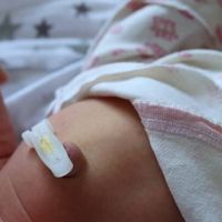 赤ちゃんのおなかの病気 臍炎 臍肉芽腫の症状とケア 医師監修 たまひよ 赤ちゃんのおなかの病気 臍炎 臍肉芽腫の症状とケア 医師監修 たまひよ