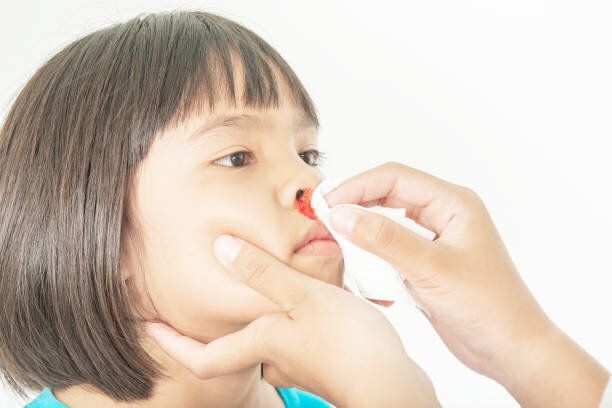 3日連日の子どもの鼻血。血液の病気かもと心配する母親に…【小児科医が解説】