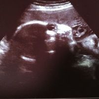 妊娠32週 赤ちゃんのエコー写真 超音波写真まとめ たまひよ 妊娠32週 赤ちゃんのエコー写真 超音波写真まとめ たまひよ