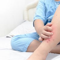 医師監修 赤ちゃんの あざ はなぜできる ほうっておいて大丈夫 9症状を小児科医が解説 たまひよ 医師監修 赤ちゃんの あざ はなぜできる ほうっておいて大丈夫 9症状を小児科医が解説 たまひよ