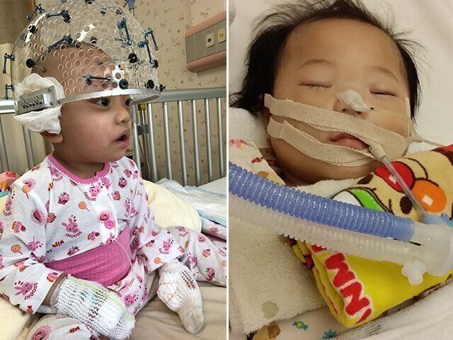 年子姉妹が2人とも難病児。孤独で、だれにも気づかれていない
