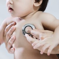 医師監修 子どものてんかんの症状 原因 診断 治療 たまひよ 医師監修 子どものてんかんの症状 原因 診断 治療 たまひよ