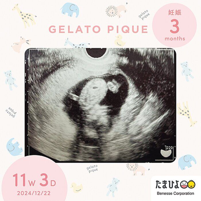 エコー写真デジタルフレーム