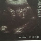 妊娠27週 赤ちゃんのエコー写真 超音波写真まとめ たまひよ