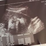 妊娠31週 赤ちゃんのエコー写真 超音波写真まとめ たまひよ