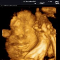 4dエコーで初めて見たわが子の顔 先生が撮った最高の1枚 たまひよ 4dエコーで初めて見たわが子の顔 先生が撮った最高の1枚 たまひよ