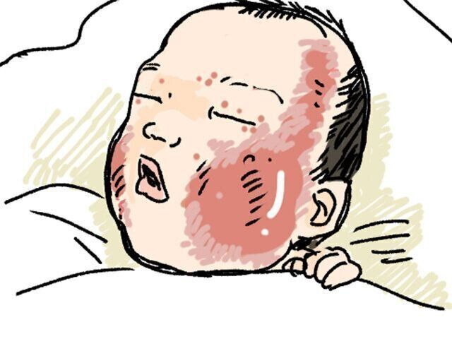 お顔が真っ赤に…“乳児湿疹”の検索沼にハマる【ツボウチ育児劇場 #７】