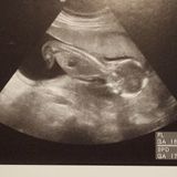 妊娠16週 赤ちゃんのエコー写真 超音波写真まとめ たまひよ