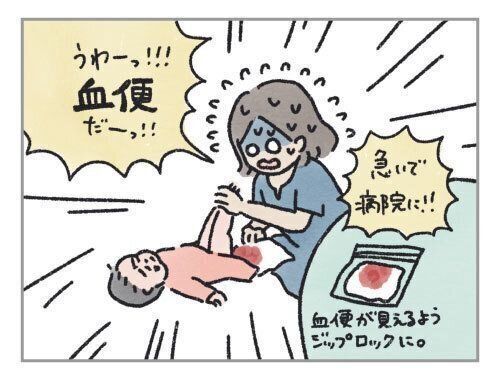 腸重積になった話　その１[ハハのさけび #22]