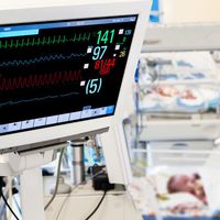 赤ちゃん 新生児の病気 呼吸窮迫症候群の症状とケア 医師監修 たまひよ