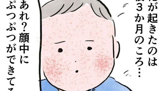 赤ちゃんの肌トラブル アレルギーに関する記事一覧 たまひよ 赤ちゃんの肌トラブル アレルギーに関する記事一覧 たまひよ