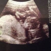 妊娠17週 赤ちゃんのエコー写真 超音波写真まとめ たまひよ 妊娠17週 赤ちゃんのエコー写真 超音波写真まとめ たまひよ