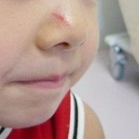 ぶどうで窒息事故発生 ミニトマト 豆も危険 お弁当に入れないで 小児科医が提言 たまひよ ぶどうで窒息事故発生 ミニトマト 豆も危険 お弁当に入れないで 小児科医が提言 たまひよ