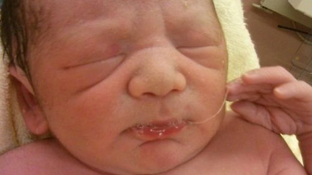 絨毛膜下血腫に関する記事一覧 たまひよ 絨毛膜下血腫に関する記事一覧 たまひよ
