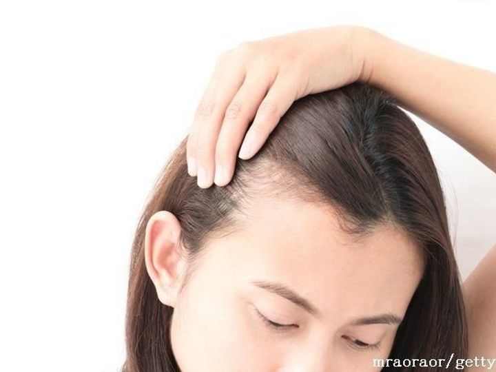 どうにかしたい 40代の薄毛問題 5分でできる簡単カバー方法って サンキュ どうにかしたい 40代の薄毛問題 5分でできる簡単カバー方法って サンキュ