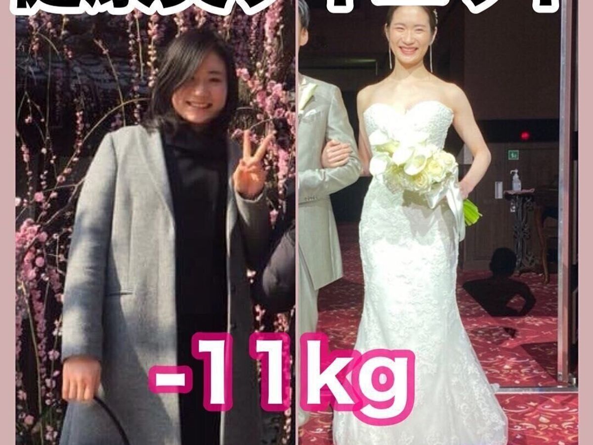 腸活で痩せる?