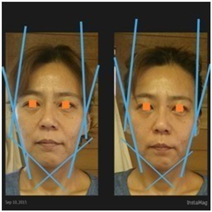 40代のたるみ ほうれい線は 骨格 が原因 簡単3stepで脱 老け顔 サンキュ 40代のたるみ ほうれい線は 骨格 が原因 簡単3stepで脱 老け顔 サンキュ