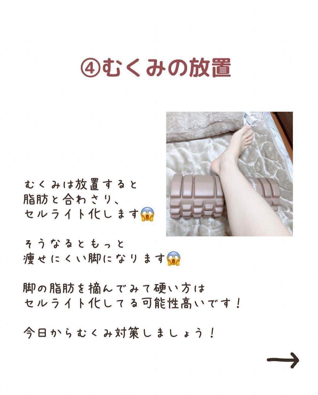 むくみをほったらかしにしてない？