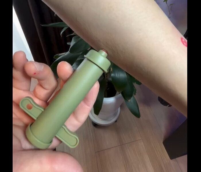 【ダイソー】毒を吸引！ポイズンリムーバー