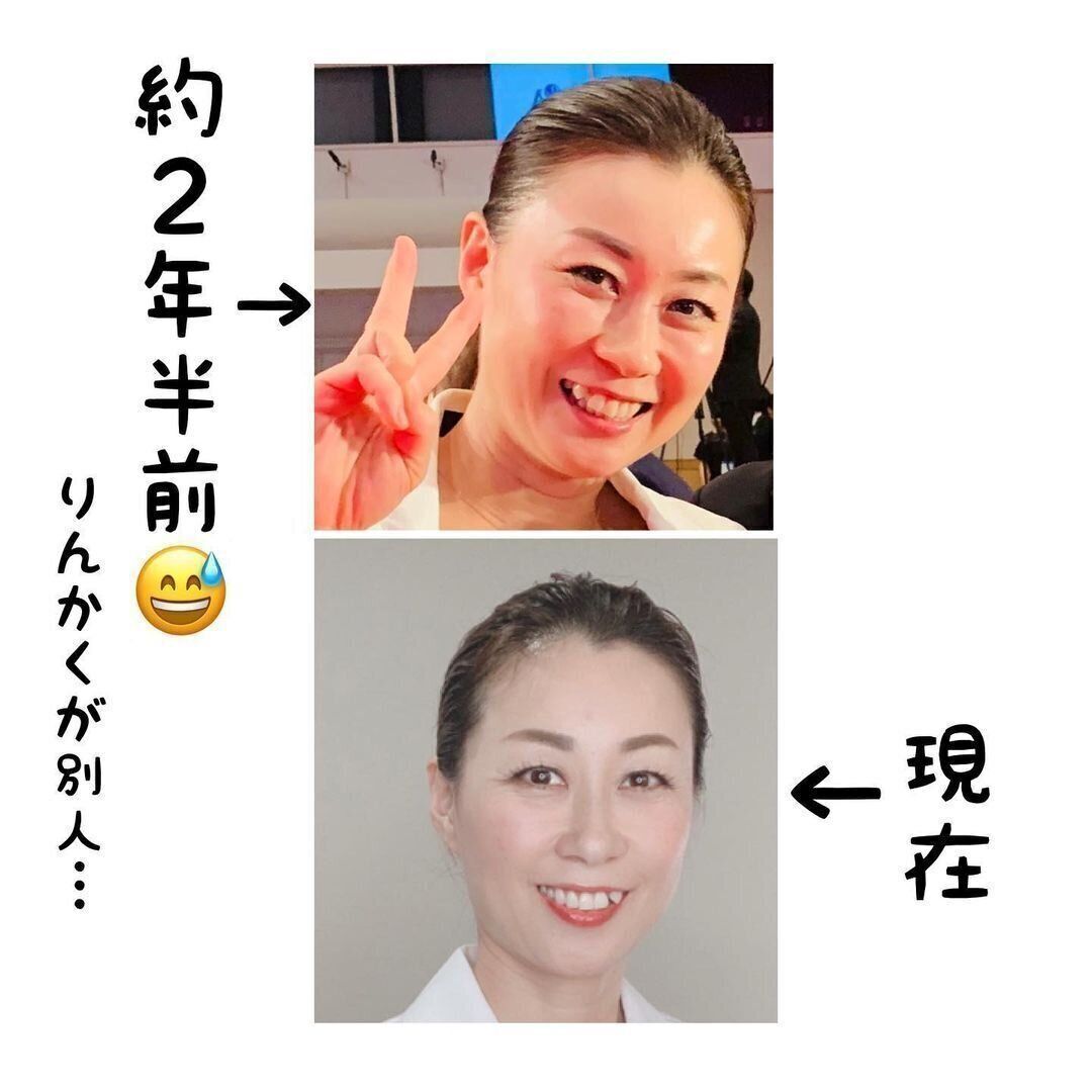 驚きのビフォアフター