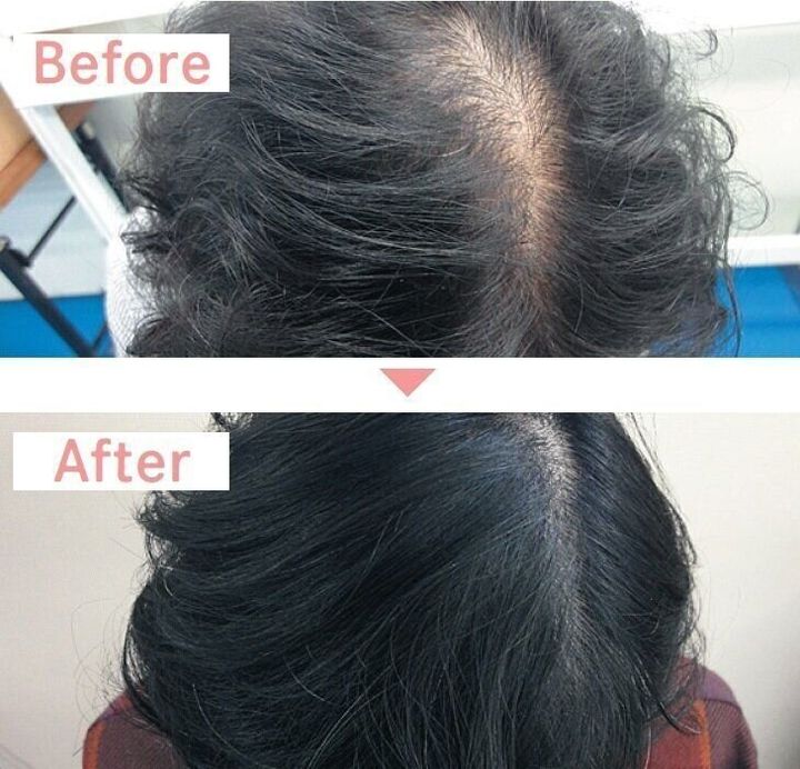 アラフォーの悩みダントツ1位の 白髪 抜いてもok 白髪染めに移行するタイミングは サンキュ アラフォーの悩みダントツ1位の 白髪 抜いてもok 白髪染めに移行するタイミングは サンキュ