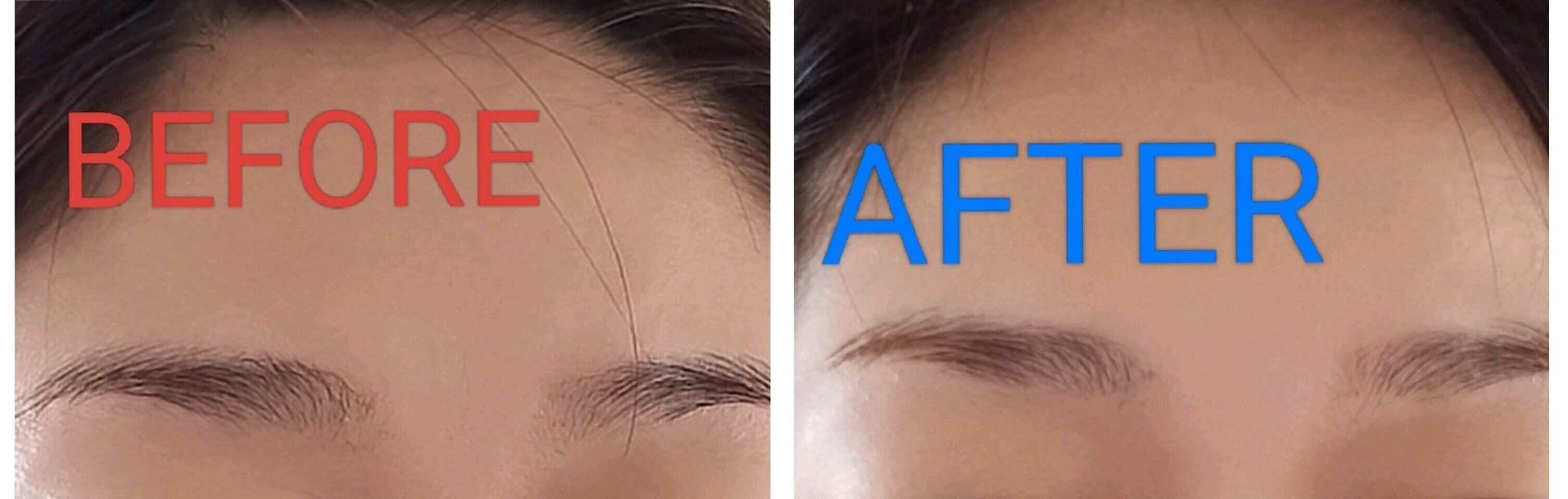 眉毛脱色ビフォーアフター