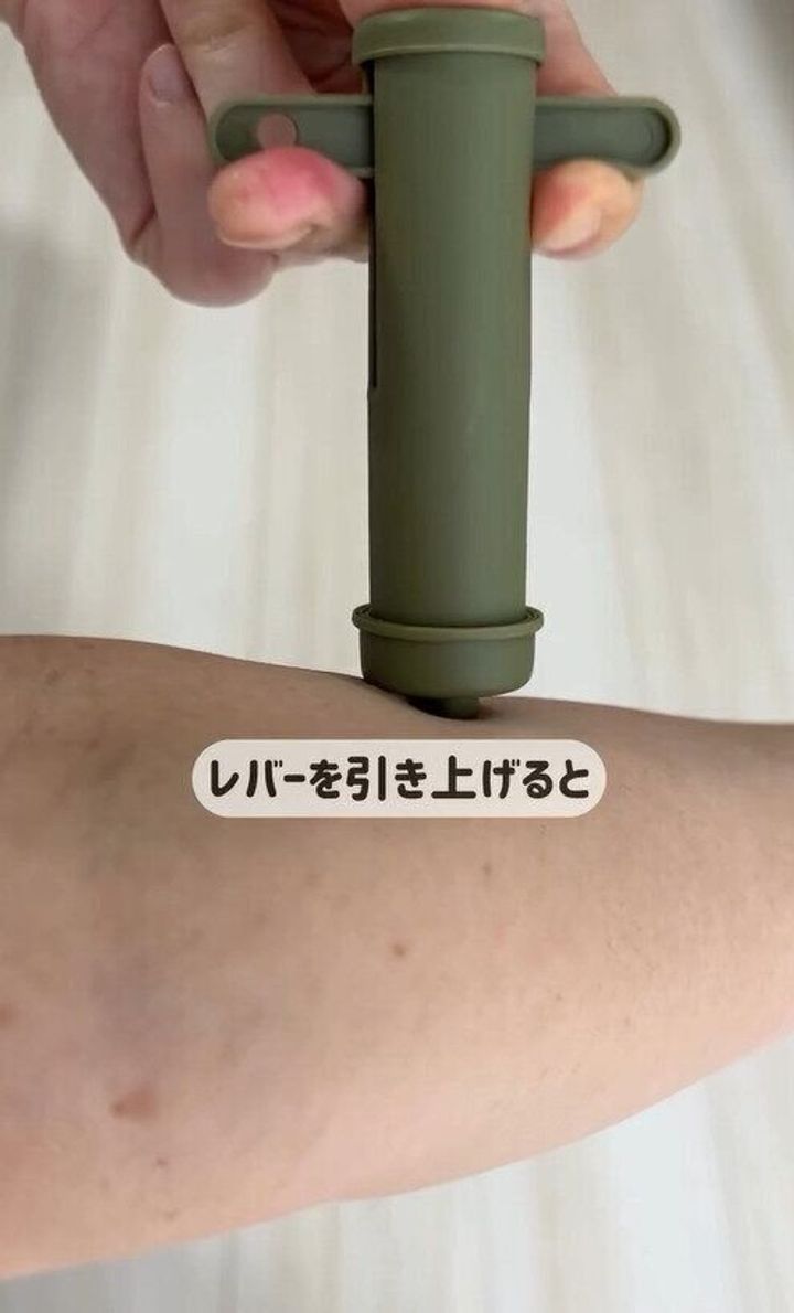 SNSでバズってた!「ポイズンリムーバー」