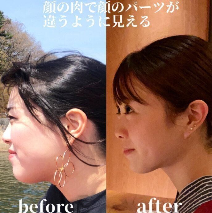 10kg痩せたら表情までこんなに変わる!ダイエットのコツは「いっぱい食べて、いっぱい動こう!」 | サンキュ!